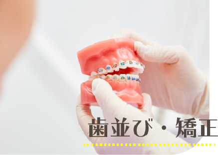 矯正歯科のイメージ